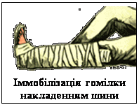 �������:  
����������� ������ ����������� ����

